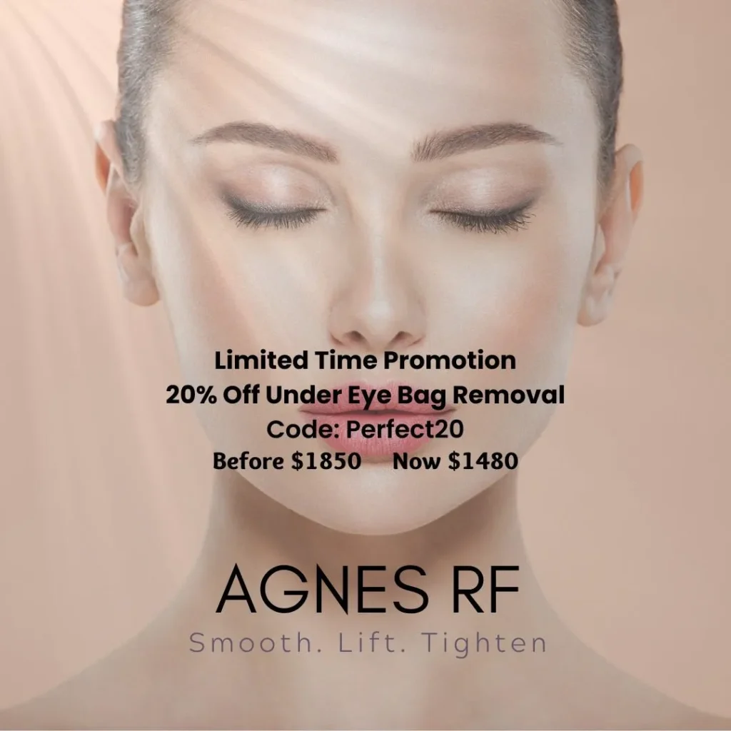 Agnes RF treatment