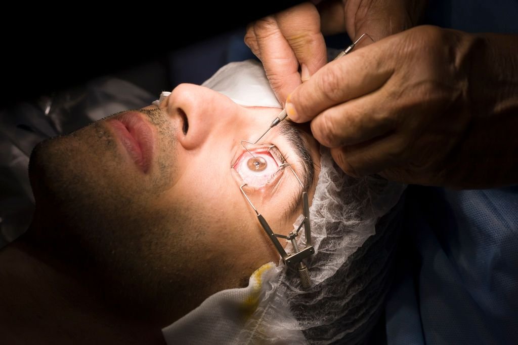 a person getting eye surgery done