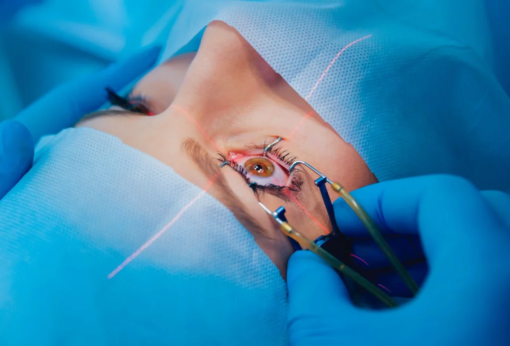 Presbyopia correction surgery