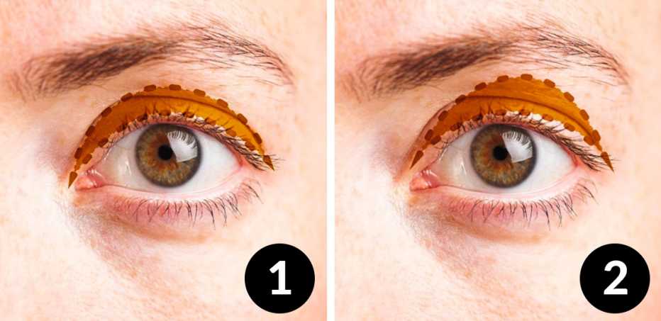 Eye Drops for Droopy Eyelids
