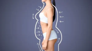 Body Sculpting
