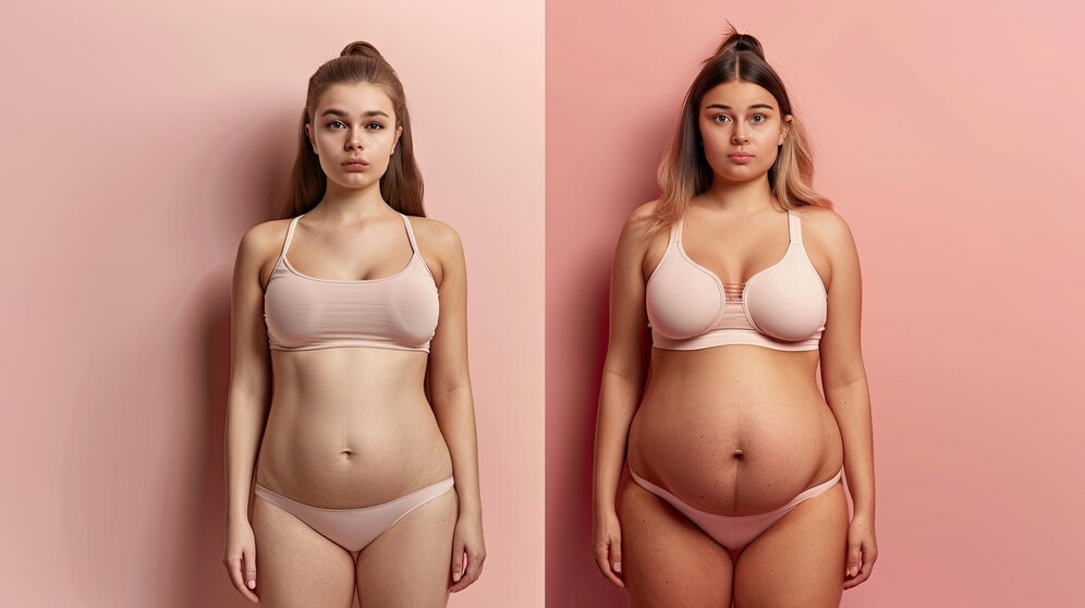 Tummy Tuck Before And After
