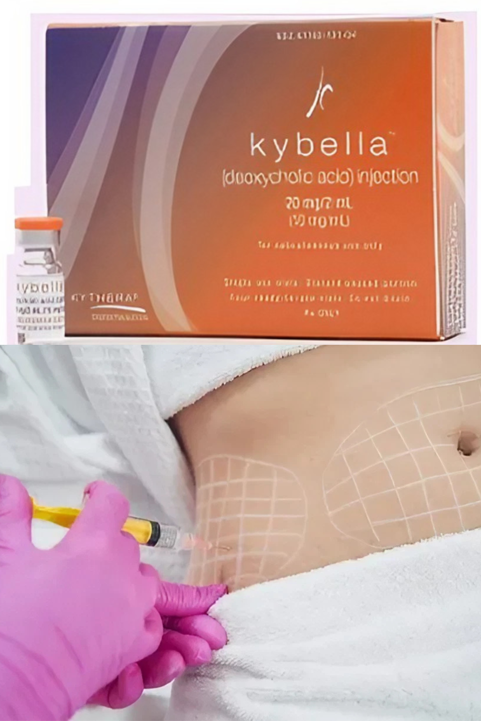kybella body contouring treatment for targeted fat reduction