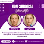 Non-Surgical Facelifts Comparing Options and Outcomes