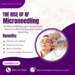 The Rise Of RF Microneedling