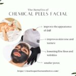 Chemical Peel