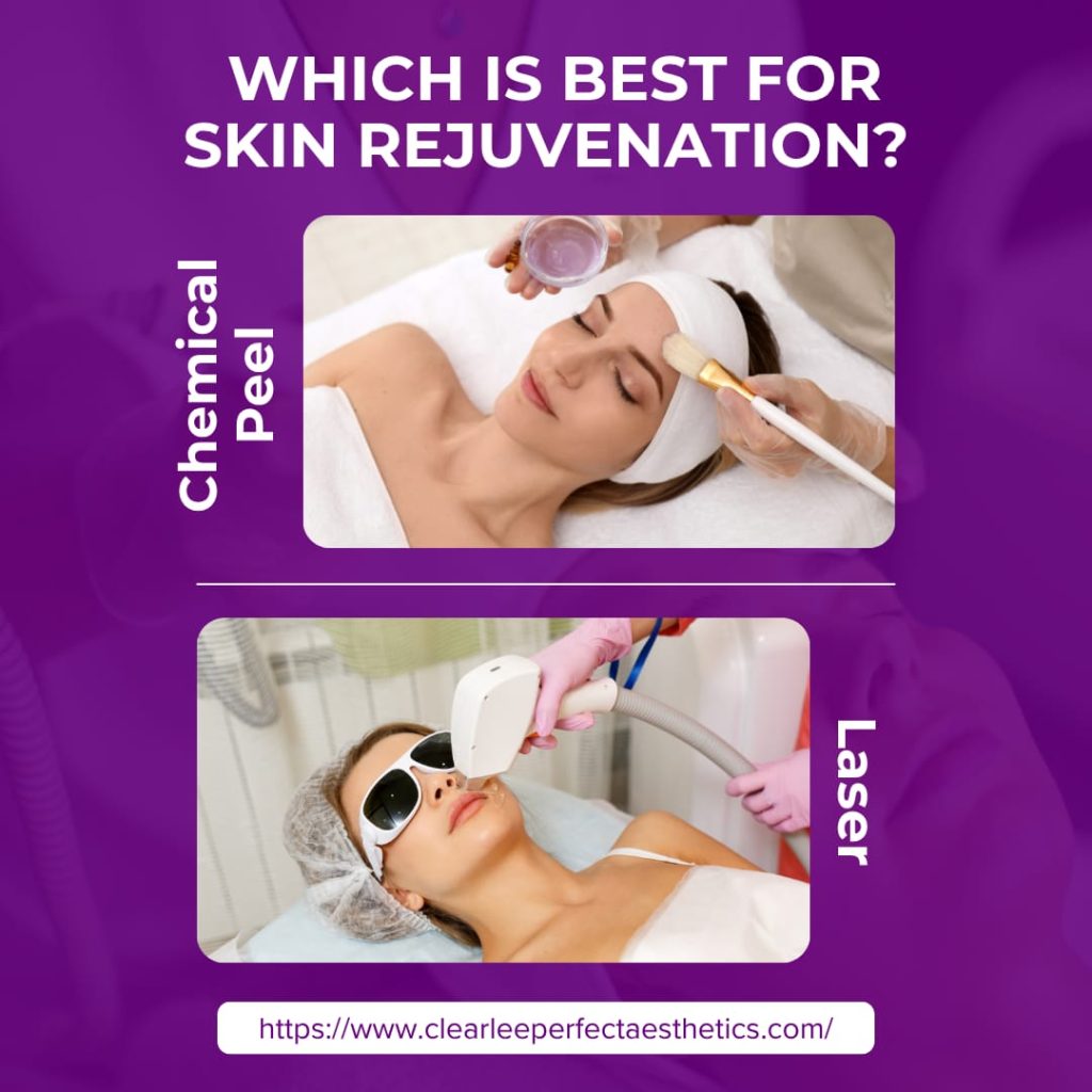 Chemical Peel vs Laser