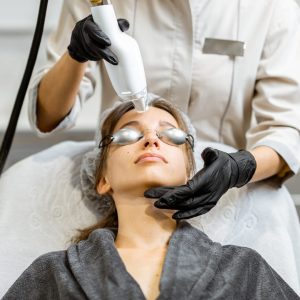 Laser Treatment for Dark Spots