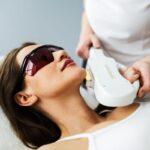 IPL Photofacial Benefits