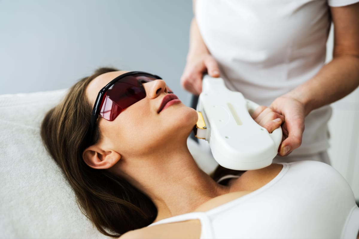 IPL Photofacial Benefits