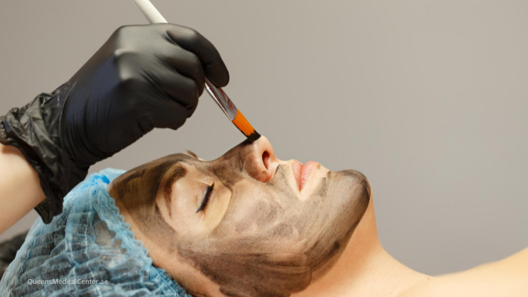 carbon laser peel in nyc