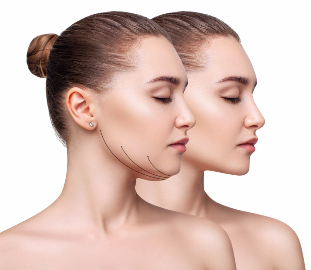 skin tightening treatments