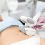 body contouring clinic