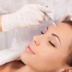 botox near me