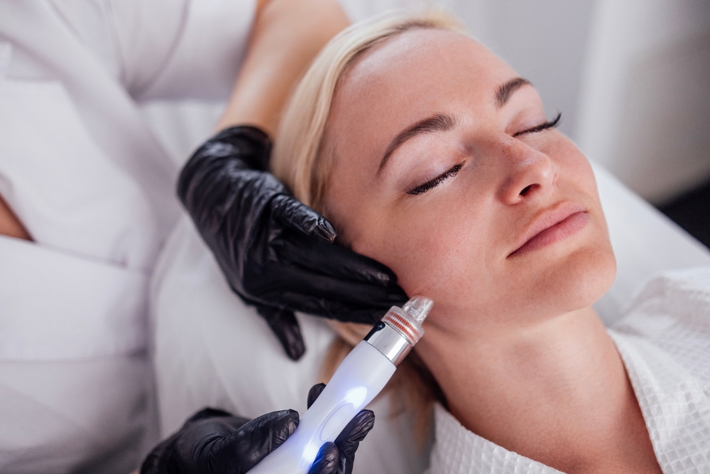CO₂ Resurfacing Laser Treatment at Clearlee Perfect Aesthetics