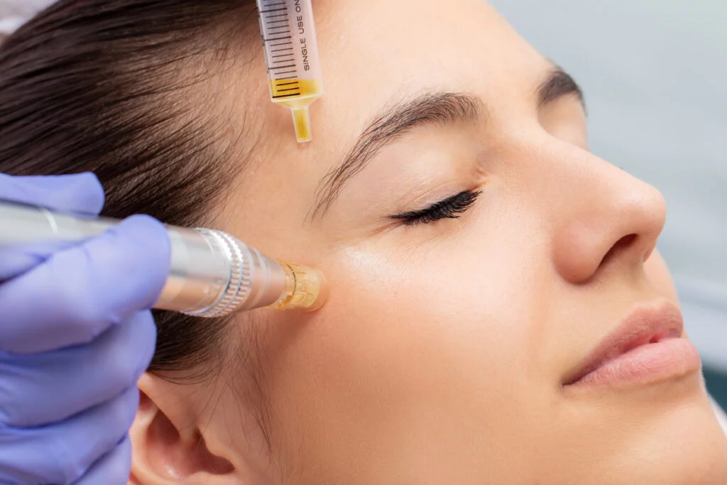 prp treatment for face
