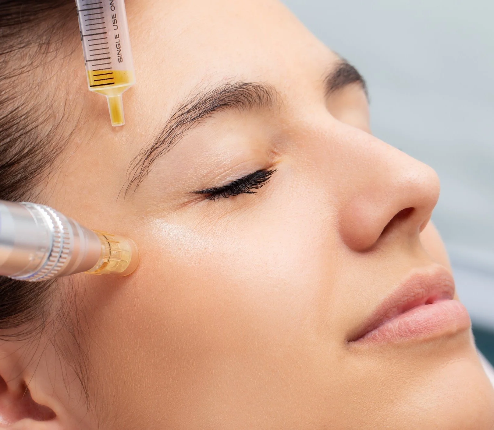 prp therapy for face At Clearlee Perfect Aesthetics