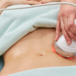 Body Contouring NYC: Advanced Non-Surgical Body Sculpting Treatments At Clearlee Perfect Aesthetics