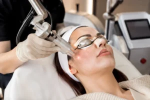 CO2 laser skin tightening procedure for firmer and smoother skin