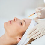 PRP Facial Treatment