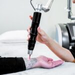 PicoSure Tattoo Removal At Clearlee