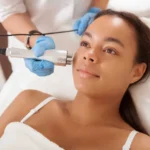 Laser hair removal for dark skin at ClearLee Perfect Aesthetics