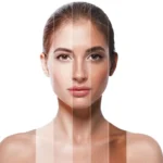 Skin Whitening Treatments