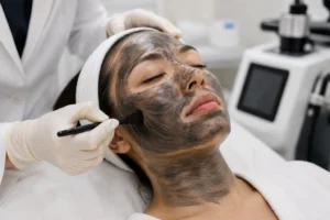 Carbon laser facial near me performed with medical-grade laser technology.