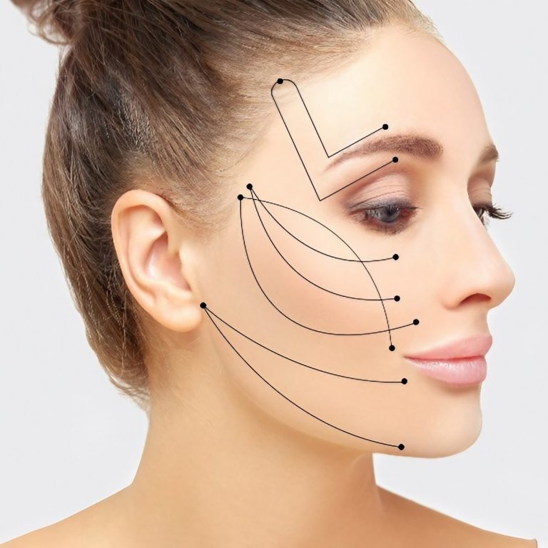 Blefaroplastica-e-minilifting