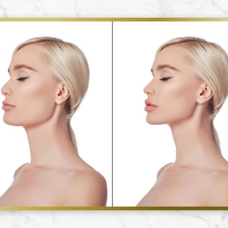 Group-807-3-600x496-1