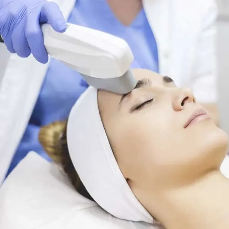 IPL Skin Rejuvenation
