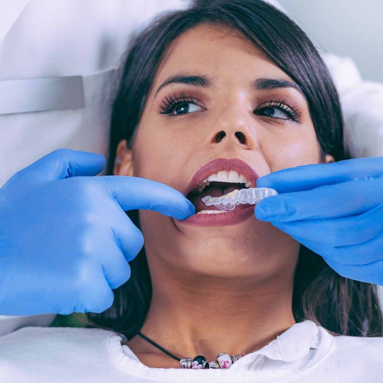 Invisalign-e1587380969565