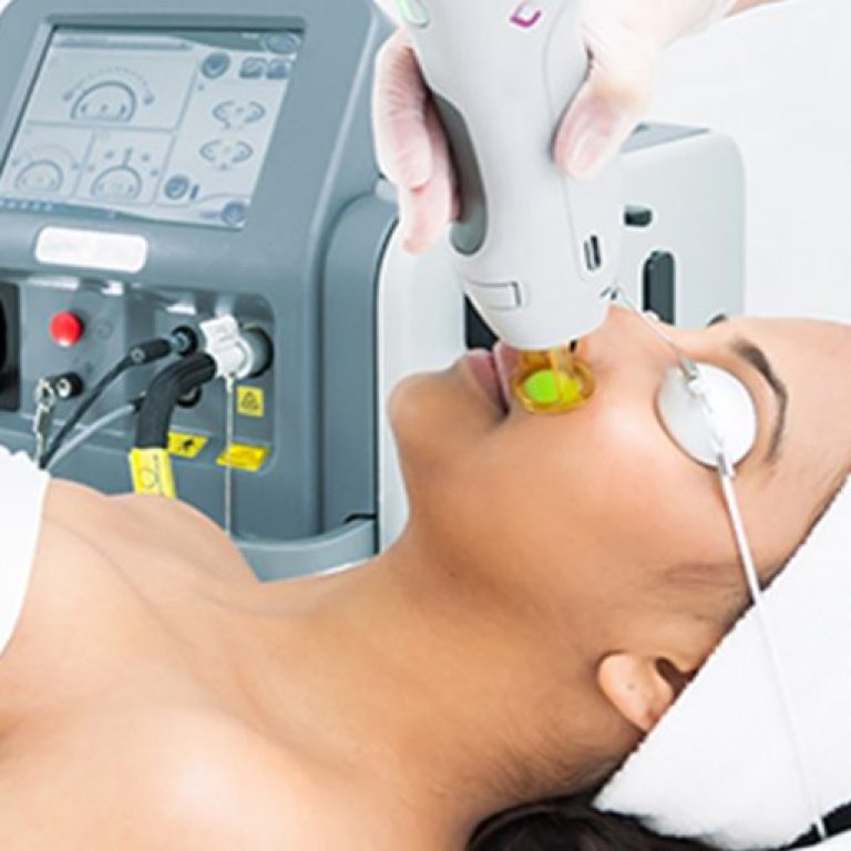 best laser hair removal near me​ Treatment machine in clinic
