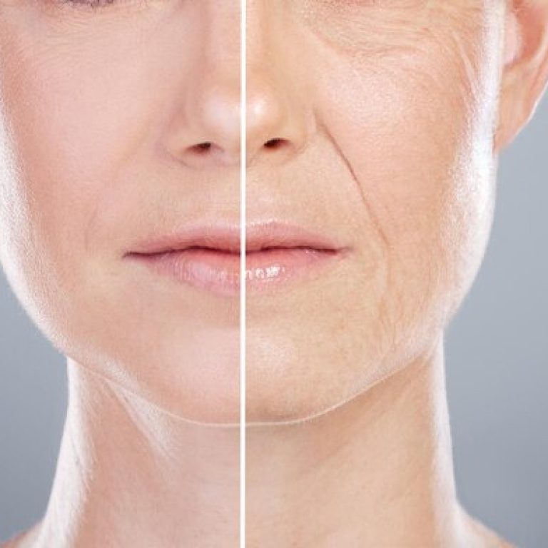 collage-before-after-face-woman-skincare-anti-aging-beauty-with-surgery-studio-female-model-transformation-makeover-with-treatment-dermatology-change-by-gray-background_590464-435593