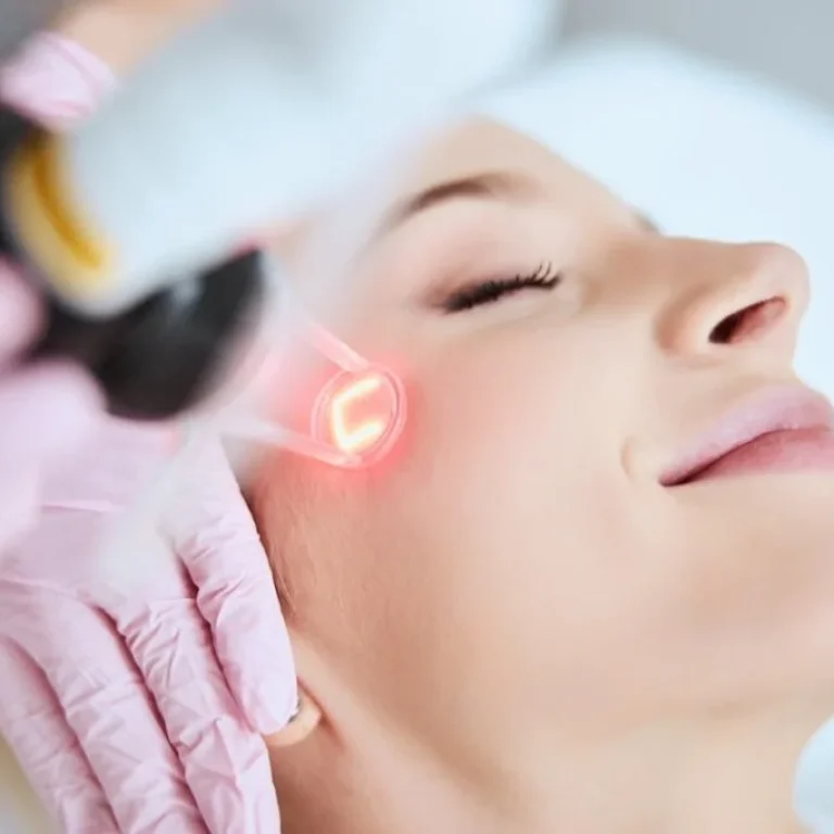 CO₂ Resurfacing Laser Treatment at Clearlee Perfect Aesthetics