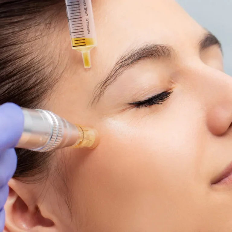 prp treatment for face