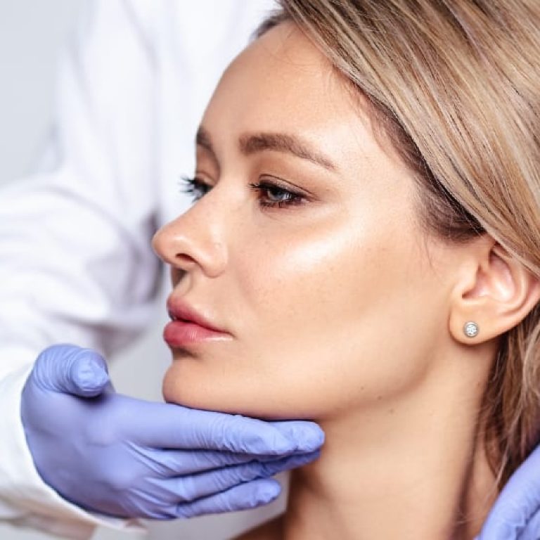 best filler for cheekbones​