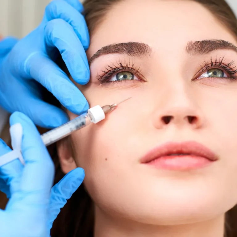 undereye-filler-tear-trough-filler