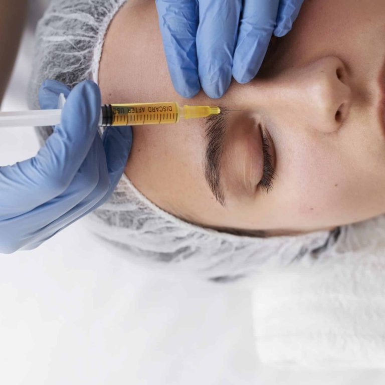 PRP Facial